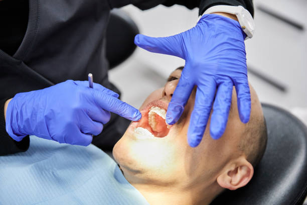 Best Broken Tooth Emergency  in Lincoln, MT